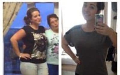 Afton before and after gastric band surgery