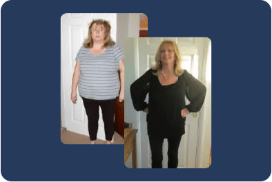 Jackie before and after weight-loss surgery from weight loss surgery Kent